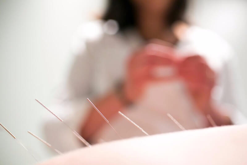 Can Acupuncture Help Insomnia?